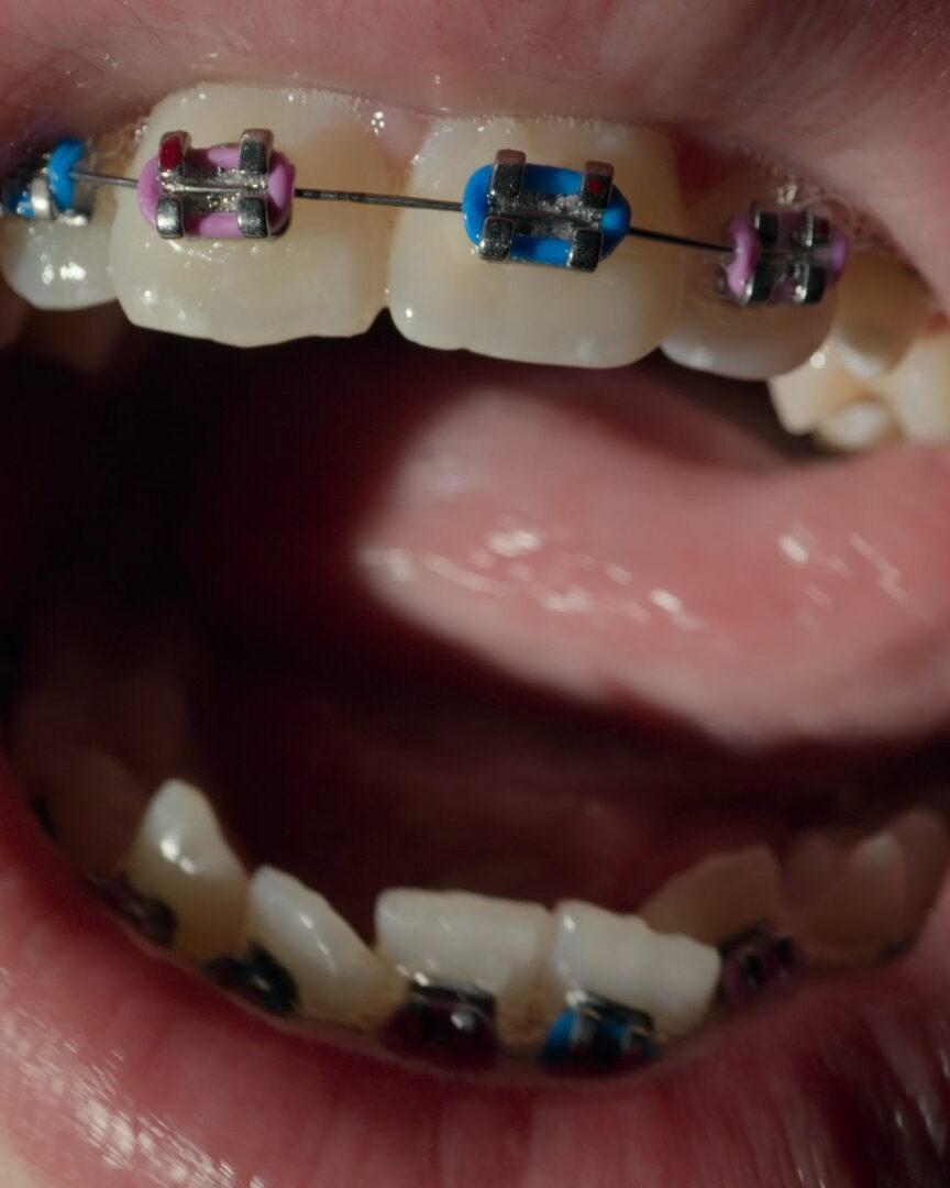 Open Wide Key Image 8x10